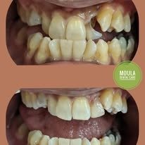 Dental Treatment